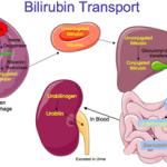 Bilirubiini